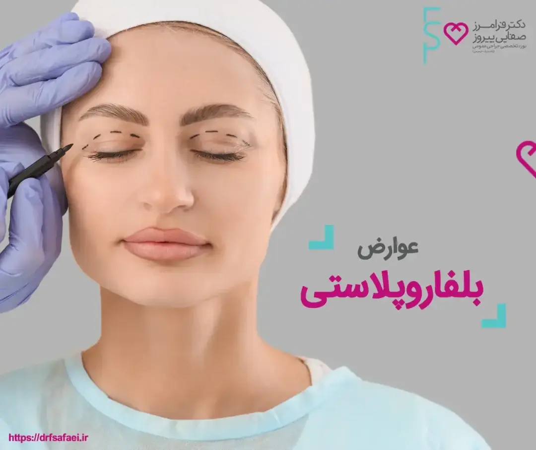 عوارض بلفاروپلاستی
