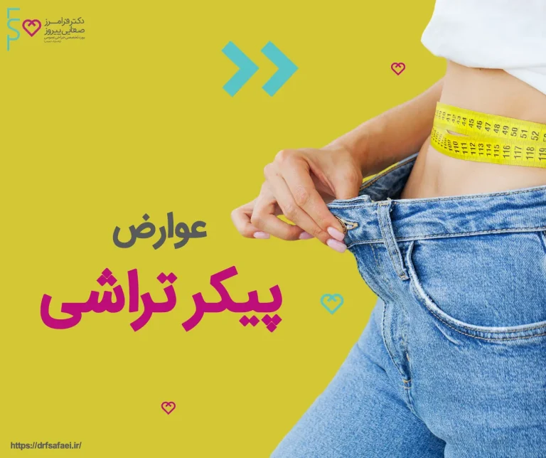 عوارض پیکر تراشی