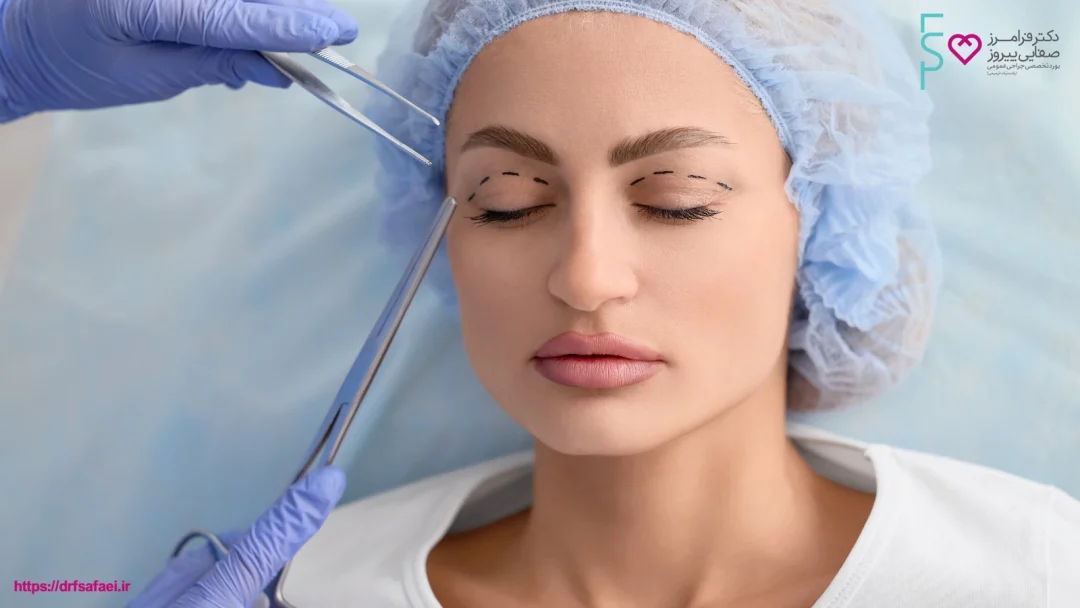 عوارض کانتوپلاستی