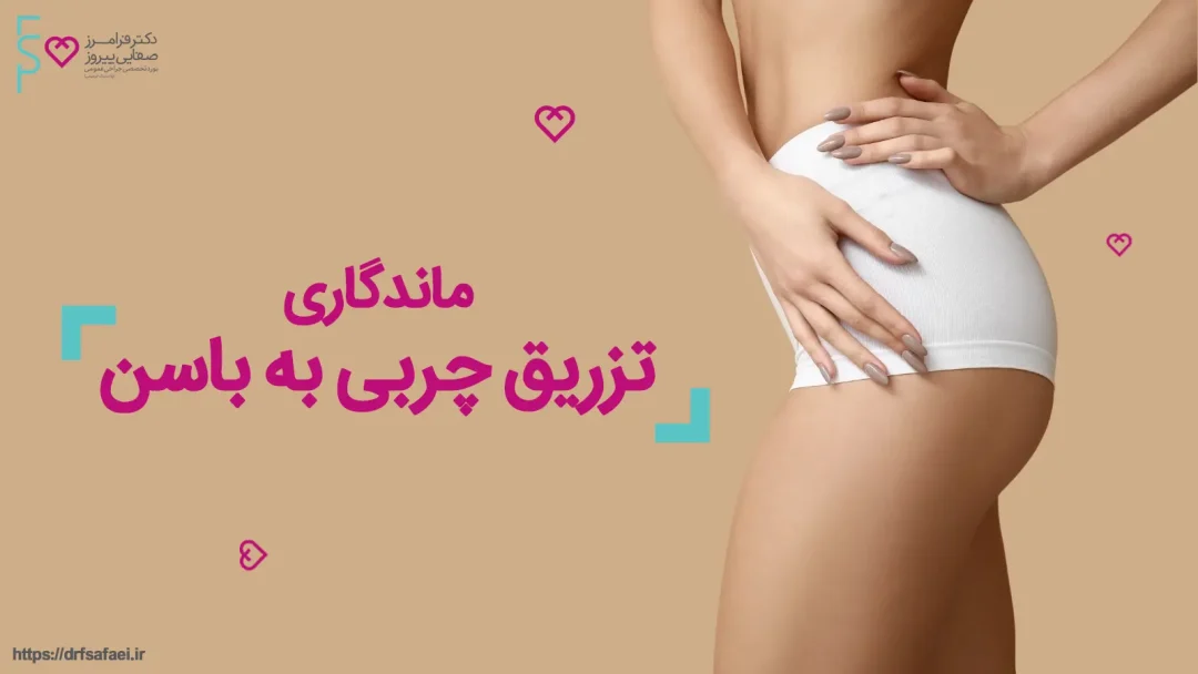 ماندگاری تزریق چربی به باسن 1