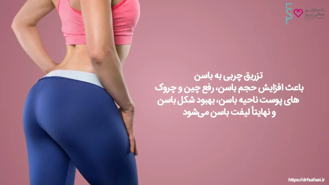 ماندگاری تزریق چربی به باسن2