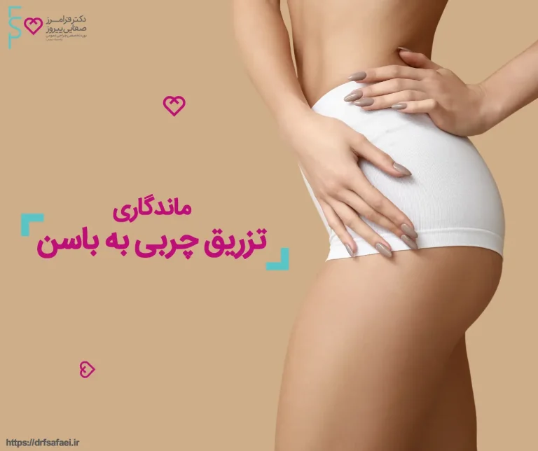 ماندگاری تزریق چربی به باسن