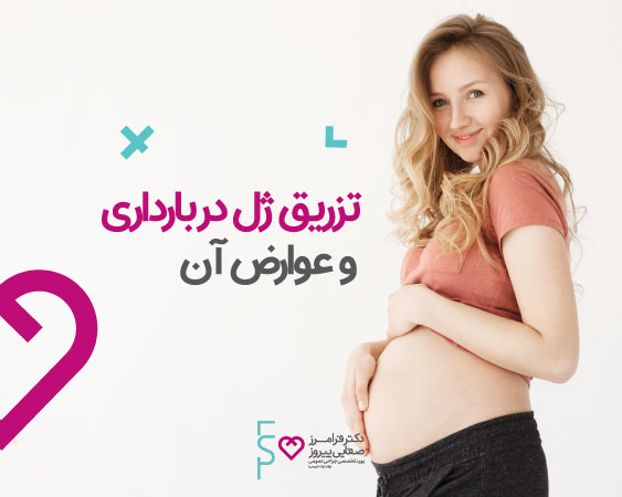 تزریق ژل در بارداری و عوارض آن