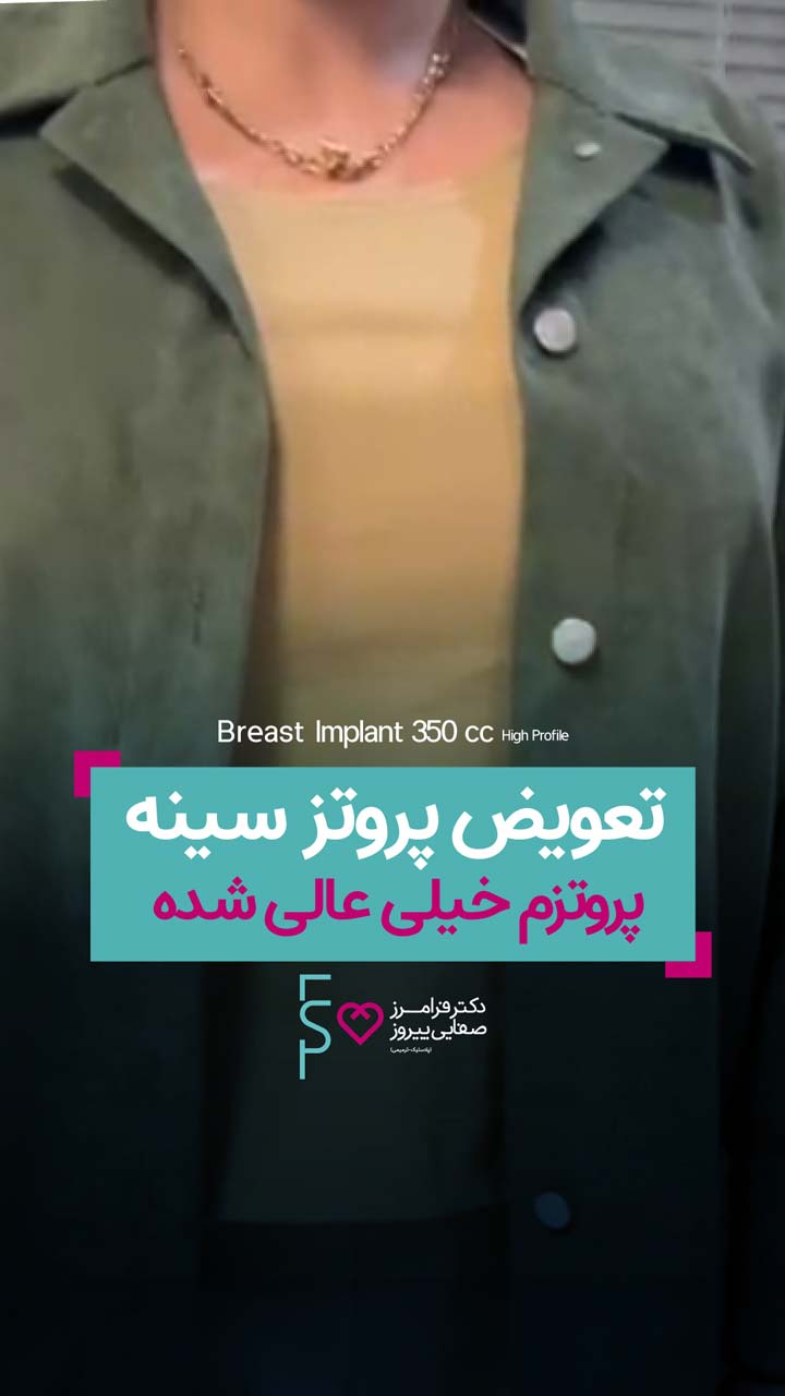 تعویض پروتز سینه