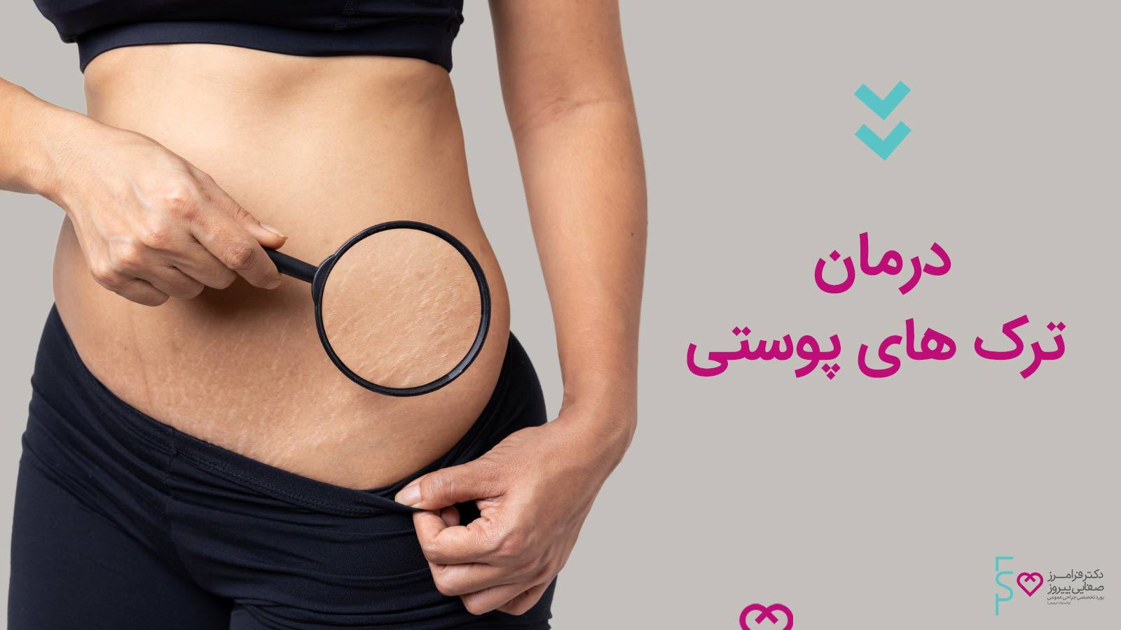 درمان ترک های پوستی