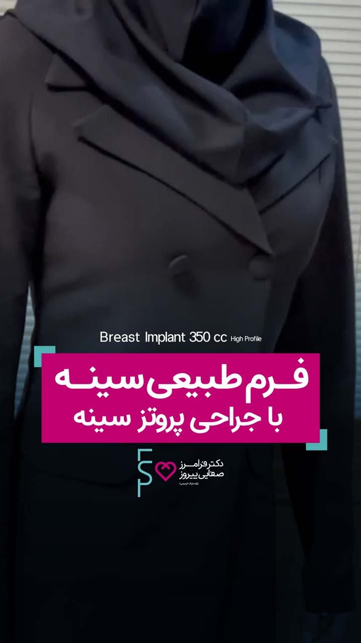 فرم طبیعی سینه با پروتز سینه