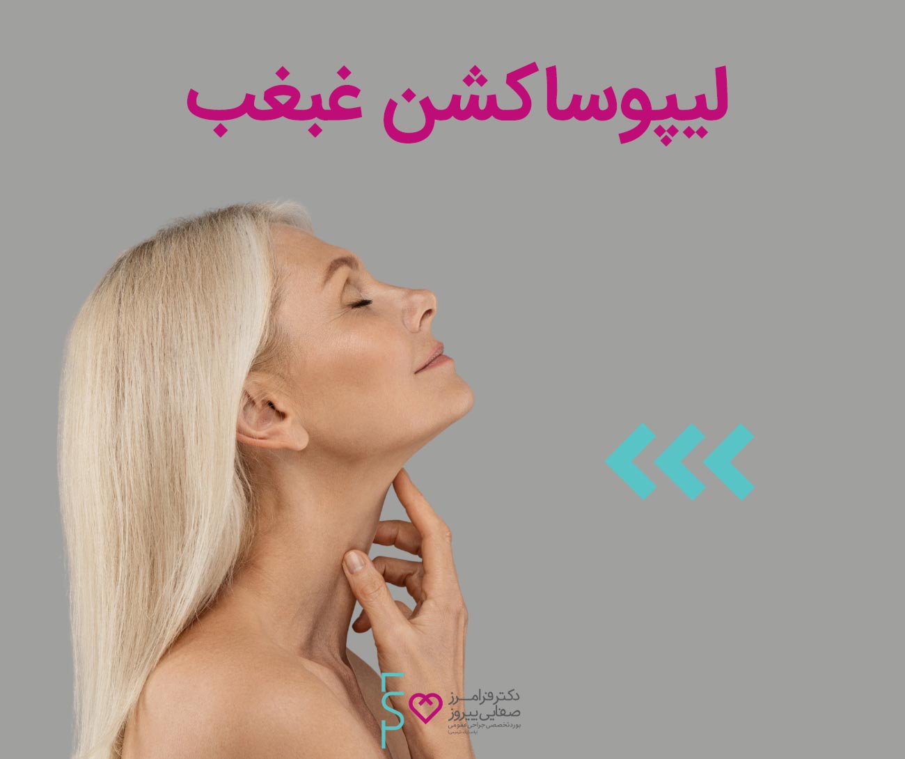 لیپوساکشن غبغب