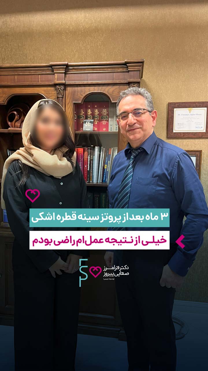 ۳ ماه بعد از پروتز سینه قطره اشکی